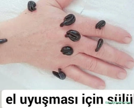 Hacamatcım Konya (Hacamat Konya)