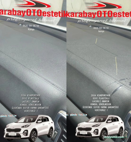 Karabayotoestetik-Plastik Göğüs Ve Tampon Tamiri