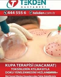 Kayseri Hacamat Tedavi Merkezi