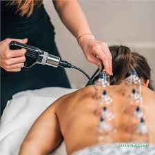 Kayseri Hacamat Tedavi Merkezi