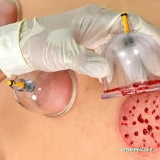 Kırşehir Sufitıbbı