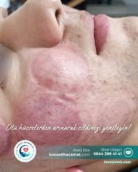 Kocaeli Hacamat Manevi Rehberlik Ve Bir.danışm.(Ev)