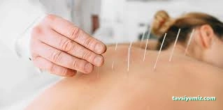 Muğla Akupunktur