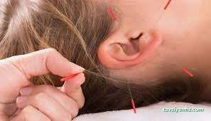 My Life Kupa Terapi Merkezi