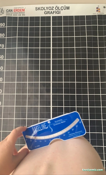 Nazlı Can Fizyotekirdağ