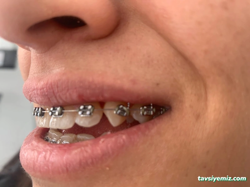 Özel Ağız Ve Diş Sağlığı Polikliniği