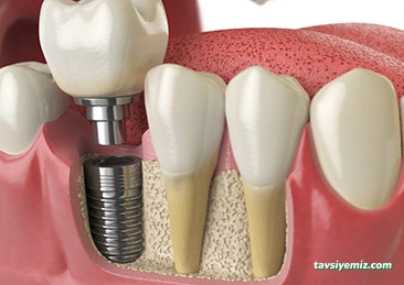 Özel Ceren Dental Ağız Ve Diş Sağlığı Polikliniği