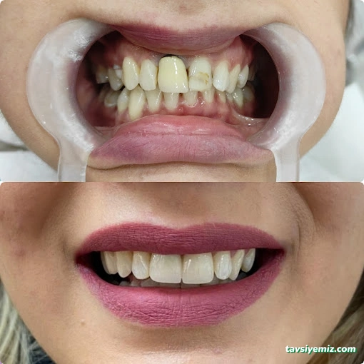 Özel Dental House Ağız Ve Diş Sağlığı Polikliniği