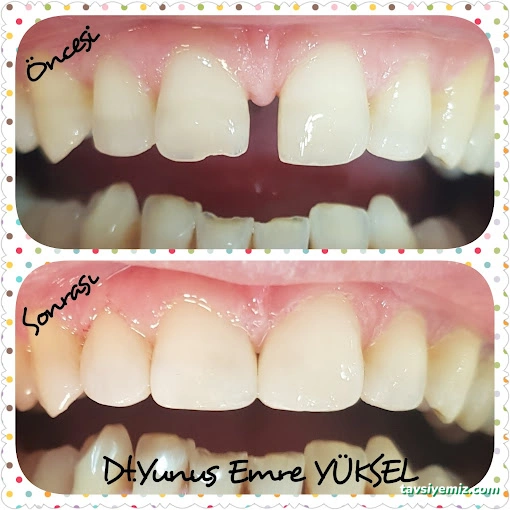 Özel Dental House Ağız Ve Diş Sağlığı Polikliniği