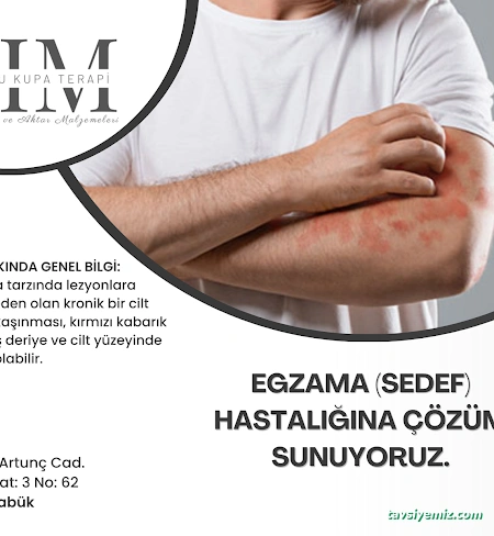 Safranbolu Kupa Terapi