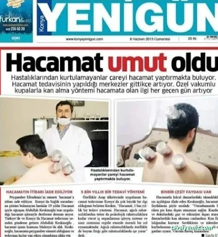 Samsun Hacamat Şifahane (Shiffa Home)