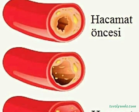 Samsun Hacamat Şifahane (Shiffa Home)