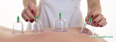 Samsun Hacamat Ve Akupunktur Malzemeleri