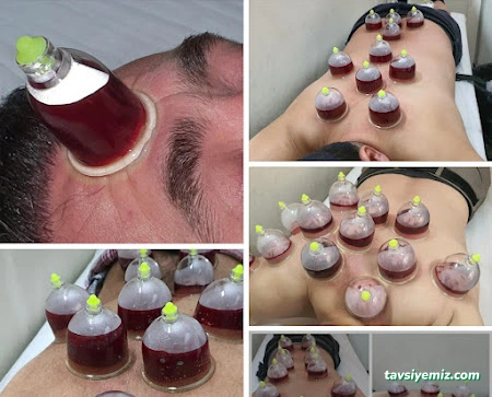 Urfa Hacamat Merkezi