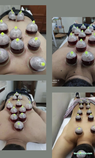 Urfa Hacamat Merkezi