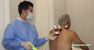 Uzm. Dr. Özgür Sinan Cengiz, Akupunktur