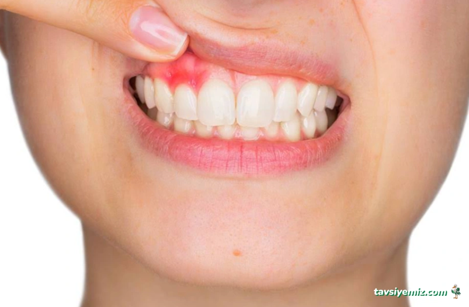 Yalova Başkent Ağız Ve Diş Sağlığı Polikliniği