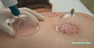 Yalova Hacamat Uzmanı