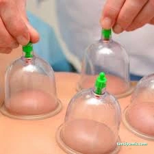 Yenimahalle Hacamat Tedavisi