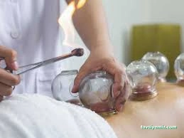 Yenimahalle Hacamat Tedavisi