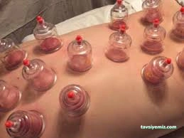 Yozgat Hacamat Uzmanı