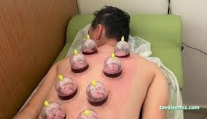 Yozgat Hacamat Uzmanı