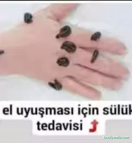 Yüksekova Hacamat Ve Sülük Tedavisi