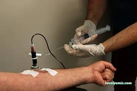 Zonguldak Ozon Akupunktur